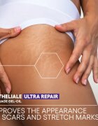 A-Derma Epitheliale A.H. Duo Massage Gel-Oil gel-ulei de masaj pentru cicatrici și vergeturi 40 ml