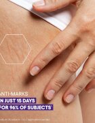A-Derma Epitheliale A.H. Duo Massage Gel-Oil gel-ulei de masaj pentru cicatrici și vergeturi 40 ml