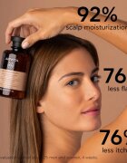 Apivita Dandruff Dry Dandruff Shampoo sampon anti-matreata 250 ml