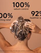 Apivita Dandruff Oily Dandruff Shampoo sampon anti-matreata pentru par gras 250 ml