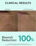 Apivita Just Bee Clear Purifying Cleanser Gel gel de curatare facial impotriva acneei 200 ml
