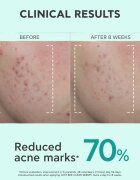 Apivita Just Bee Clear Serum ser pentru ten gras si problematic 30 ml