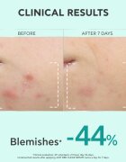 Apivita Just Bee Clear Serum ser pentru ten gras si problematic 30 ml