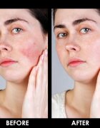 Arval Couperoll Anti-redness Night Cream & Mask cremă-mască de noapte pentru piele sensibila si inrosita 50 ml