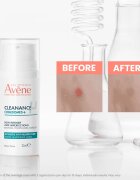 Avène Cleanance Comedomed+ ingrijire intensiva impotriva imperfectiunilor pielii cauzate de acnee 30 ml