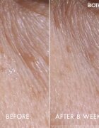 Biotherm Blue Peptides Eyes Lips Contour Reshaper ingrijirea pielii din jurul ochilor si a buzelor 15 ml