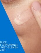 CeraVe Control Cleanser & Retinol Serum Duo ingrijire completa impotriva imperfectiunilor pielii cauzate de acnee