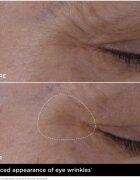Clarins Double Serum Eye Crema anti-rid pentru zona ochilor cu efect de nutritiv 20 ml