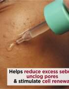 Clarins My Pure-Reset Resurfacing Blemish Serum ser revigorant pentru tenul gras predispus la acnee 30 ml