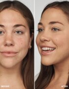 Clinique Even Better™ Clinical Serum Foundation machiaj de îngrijire SPF 20 culoare WN 46 Golden Neutral 30 ml