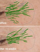 Clinique Smart Clinical™ Repair Wrinke Correcting Serum ser facial pentru corectarea ridurilor 100 ml