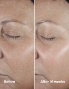 Clinique Smart Clinical™ Repair Wrinke Correcting Serum ser facial pentru corectarea ridurilor 100 ml