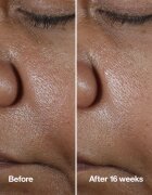 Clinique Smart Clinical™ Repair Wrinke Correcting Serum ser facial pentru corectarea ridurilor 100 ml