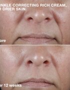 Clinique Smart Clinical™ Repair Wrinkle Correcting Cream cremă nutritivă antirid 50 ml