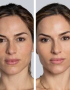 Cocunat Clinical The Real C ser facial cu vitamina C 30 caps.