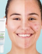 Dermedic Normacne Therapy cremă hidratantă pentru ten acneic 40 ml