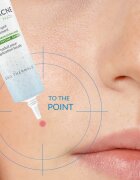 Dermedic Normacne Therapy tratament local impotriva acneei 15 g