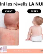 Doucea Doutopia Cream crema de regenerare pentru piele atopica pentru copii si adulti 50 g