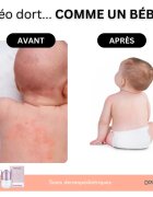 Doucea Doutopia Cream crema de regenerare pentru piele atopica pentru copii si adulti 50 g