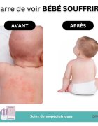 Doucea Doutopia Cream crema de regenerare pentru piele atopica pentru copii si adulti 50 g