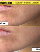 Dr. Jart+ Ceramidin™ Ectoin-Infused Cream crema de fata hidratanta cu ceramide 50 ml
