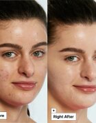 Dr. Jart+ Cicapair™ Tiger Grass Color Correcting Treatment Crema intensiva impotriva inrosirii pielii. 30 ml