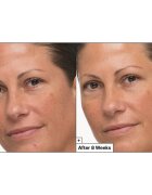 Dr. Jart+ Prejuvenation Cream with Bakuchiol Crema regeneratoare si de intarire. anti-imbatranire 50 ml
