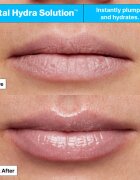 Dr. Jart+ Vital Hydra Solution™ Hydrating Lip Mask Jelly Bear Edition mască hidratantă pentru buze 20 ml