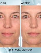 Elizabeth Arden Hyaluronic Acid + Peptides Ceramide capsule cu serum facial s ceramidy a peptidy 60 caps.