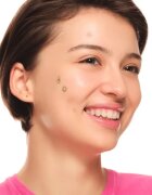essence Spot Squad Pimple Patches plasturi pentru piele problematică 32 buc