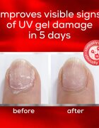 Essie to the rescue lac de unghii pentru ingrijire pe unghiile distruse 13.5 ml
