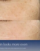 Estée Lauder Advanced Night Repair Serum Synchronized Multi-Recovery Complex ser pentru contur 7 ml