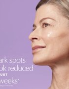 Estée Lauder Perfectionist Pro Rapid Brightening Treatment with Ferment³ + Vitamin C ser stralucire cu vitamina C impotriva petelor intunecate 50 ml