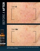 FILORGA DAILY PEEL ANTI-DARK SPOT exfoliant facial impotriva petelor intunecate 50 ml