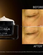 FILORGA GLOBAL-REPAIR ADVANCED EYES & LIPS crema anti-rid pentru conturul ochilor si buzelor 15 ml