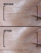 FILORGA TIME-FILLER SHOT ser intensiv impotriva primelor semne de imbatranire ale pielii 15 ml