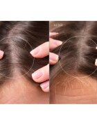FOREO FAQ™ Scalp Recovery & Thick Hair Probiotic Serum ser probiotic pentru regenerarea părului și a scalpului 60 ml