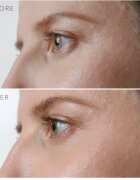 FOREO IRIS™ Firming Eye Serum Ser de Ochi pentru Întinerire 15 ml