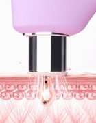 FOREO KIWI™ Derma aparat pentru microdermabraziune cu diamante și curățarea porilor 1 buc