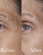 fresh Black Tea Age Renewal Eye Concentrate crema pentru ochi cu efect de reintinerire 15 ml