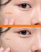 Frudia Citrus ser facial cu efect iluminator cu vitamina C 30 ml