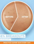 Garnier Ambre Solaire Super UV Niacinamide fluid protecție impotriva imperfectiunilor pielii SPF 50+ 40 ml
