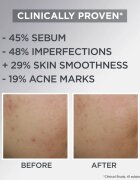 Garnier Pure Active gel crema deschisa pentru pielea cu imperfectiuni 50 ml