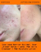 Glow Hub The Scar Slayer ser cu efect iluminator impotriva petelor 30 ml