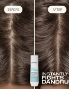 Goldwell Dualsenses Scalp Specialist Anti-Dandruff Shampoo sampon anti-matreata 250 ml