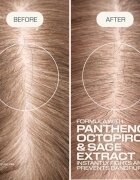 Goldwell Dualsenses Scalp Specialist Anti-Dandruff Shampoo sampon anti-matreata 250 ml