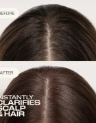 Goldwell Dualsenses Scalp Specialist Clarifying Shampoo curatarea profunda a scalpului 1000 ml