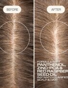 Goldwell Dualsenses Scalp Specialist Clarifying Shampoo curatarea profunda a scalpului 250 ml