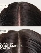 Goldwell Dualsenses Scalp Specialist Rebalance & Hydrate Fluid fluid hidratant pentru refacerea scalpului 150 ml