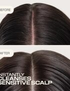 Goldwell Dualsenses Scalp Specialist Sensitive Foam Shampoo sampon spuma pentru piele sensibila 250 ml